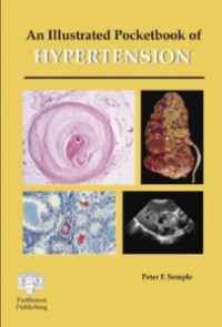 Image of AN ILLUSTRATED POSKETBOOK OF HYPERTENSION